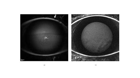 Indena See Through Science Quercefit