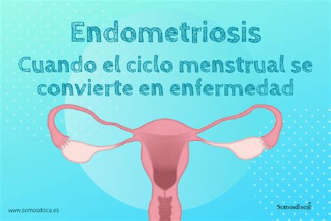 Día Mundial De La Endometriosis Somosdisc