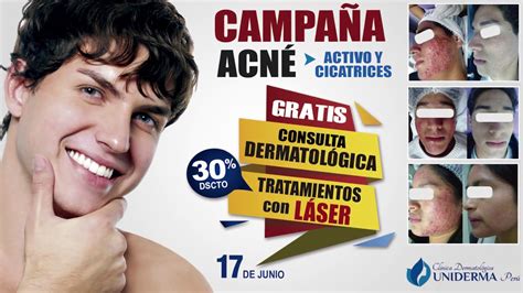 Campa A De Acn Y Secuelas De Acn Gratis Youtube