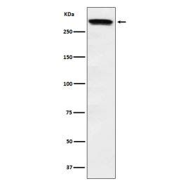 Anti Huntingtin Monoclonal Antibody IF Validated Bosterbio