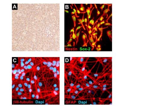 Rencell Vm Human Neural Progenitor Cell Line Scc