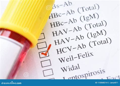 Hepatitis C virus test stock photo. Image of scientific - 115068214