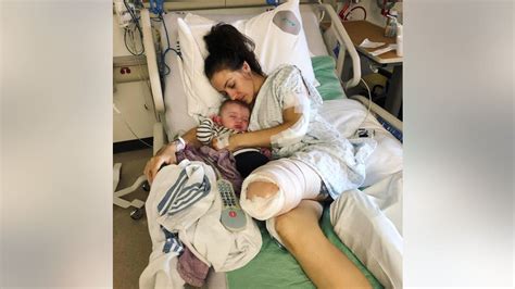 Mom Grateful To Be Alive After Losing Leg In Horror Motorcycle Accident Health Worlds News