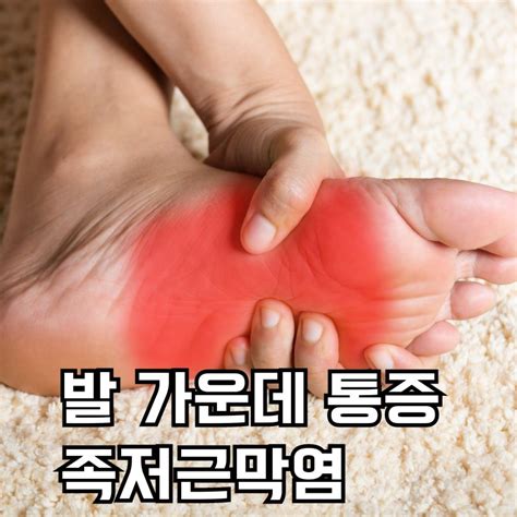 발 가운데 통증 있다면 족저근막염 원인 증상 치료법 확인하세요 건강백서