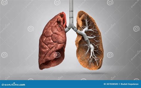 3D Rendering Of Human Lungs With Bronchial Tree Stock Illustration