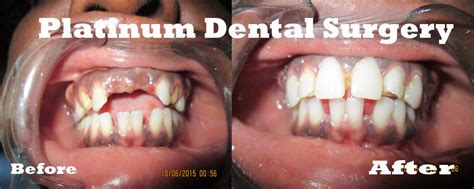 Platinum Dental Surgery Platinum Dental Surgery Dental Clinic In