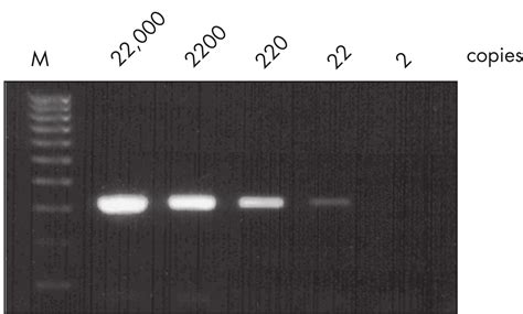 Qiagen Onestep Rt Pcr Kit