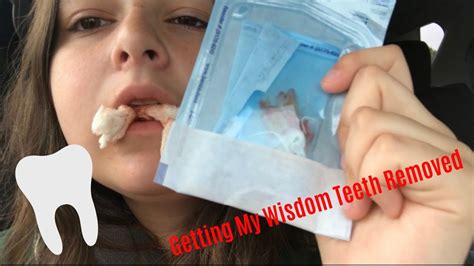 Getting My Wisdom Teeth Taken Out Youtube