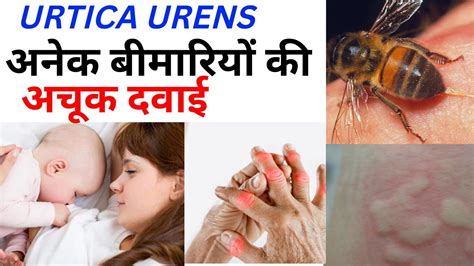 Urtica Urens Homeopathic Medicine Youtube