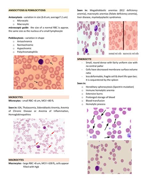 Anisocytosis and Poikilocytosis - ANISOCYTOSIS & POIKILOCYTOSIS Anisocytosis - variation in size ...