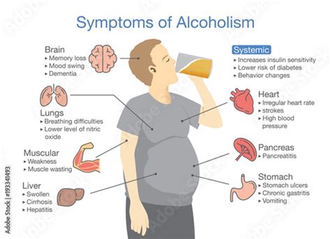 Symptom Of Alcoholism Patient Illustration About Health Problem Of