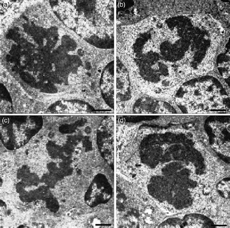 Electron Micrographs Of The Ultrathin Sections Showing Cells In Mitotic