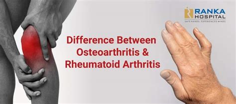 Difference Between Osteoarthritis And Rheumatoid Arthritis Ranka Hospital