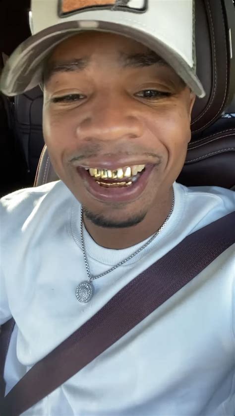 Kanye West Gold Teeth