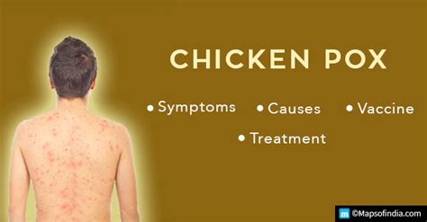 Chickenpox: Symptoms, Causes, Vaccine and Treatment - Education Blogs