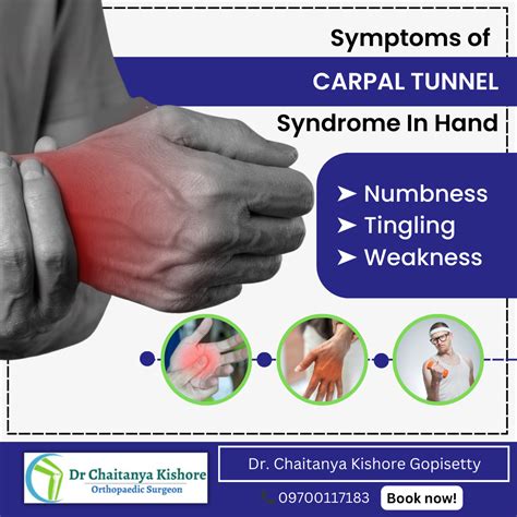 Carpal Tunnel Syndrome Cts Carpal Tunnel Syndrome Cts Is A… By