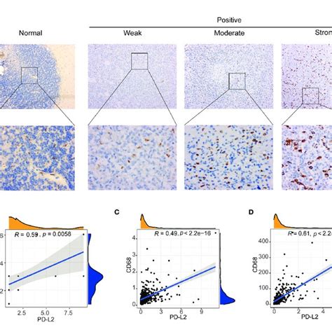 Correlation Between PD L2 Expression And Macrophages Marker CD68