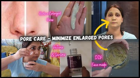 How To Treat Open Enlarged Pores Actives Fro Enlarged Pores Diy