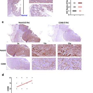 Notch3 Expression Was Significantly Positively Correlated With