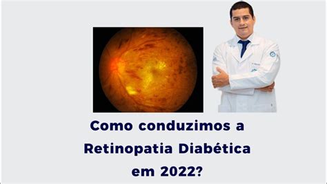 Retinopatia Diab Tica O Que Voc Precisa Saber