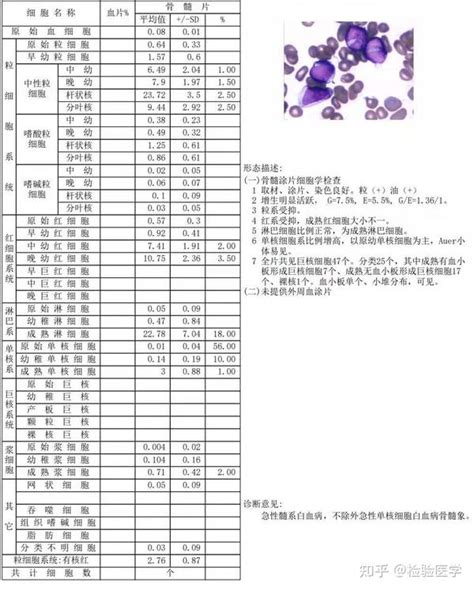 急性单核细胞白血病分型，你真的清楚吗？ 知乎