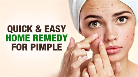 How To Remove Pimples Fast At Home Home Remedy For Pimple Beauty Tips By Riya Singh Youtube