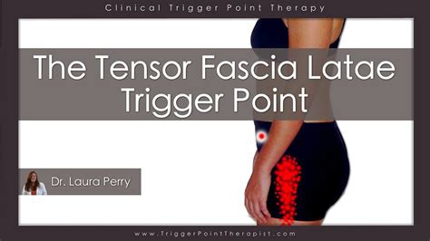 The Tensor Fascia Latae Trigger Points Youtube