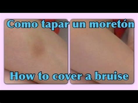 Como cubrir un moretón How to cover a bruise YouTube