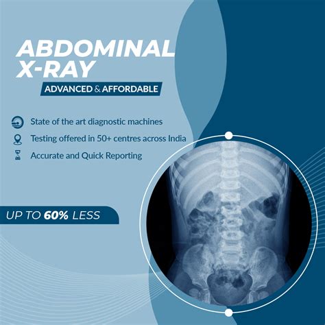 Abdominal X Ray Aarthi Scans And Labs