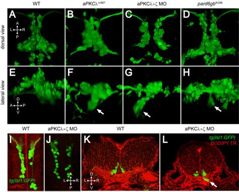 Par Apkc Complex Disruption Causes A Ventral Mismigration In Which Download Scientific Diagram