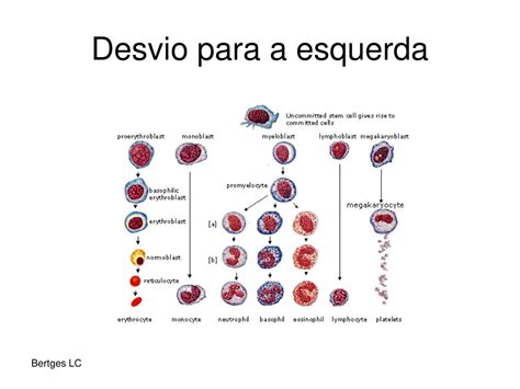 Desvio A Esquerda Hemograma