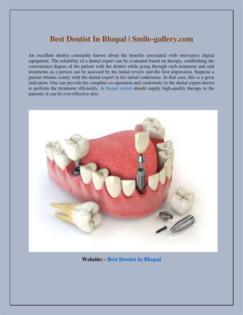 Ppt Best Dentist In Bhopal Smile Gallery Powerpoint Presentation