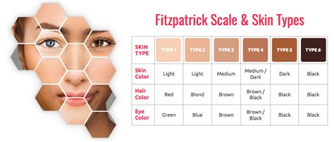 Fitzpatrick Skin Type Chart