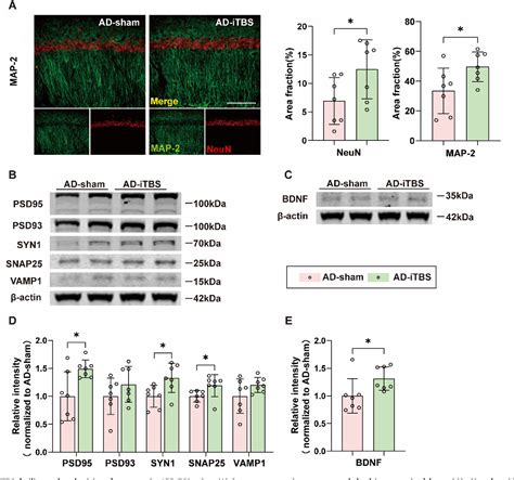 Figure 1 From The Long Term Effects Of Intermittent Theta Burst Stimulation On Alzheimers