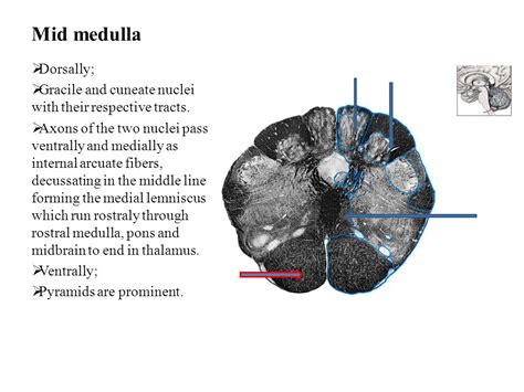 Internal Structure Of Medulla Oblongata Ppt Video Online Download