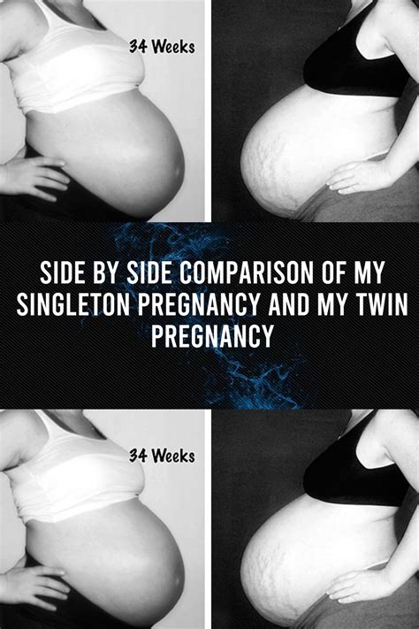 Side By Side Comparison Of My Singleton Pregnancy And My Twin Pregnancy