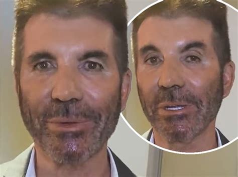 Simon Cowell Sparks Concern As He Looks Unrecognizable In Bgt Video