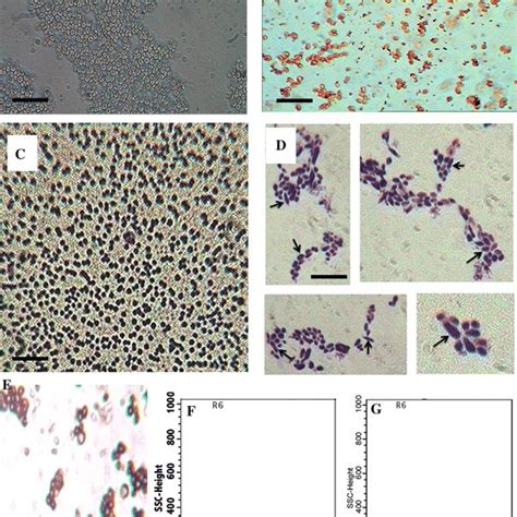 Cd34⁺ Stem Cells Characterization Before And After Differentiation A