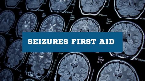 Seizure First Aid Causes Symptoms And Treatment Explained