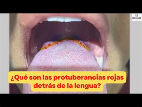 Descubre por qué los bultos al final de la lengua son más que una