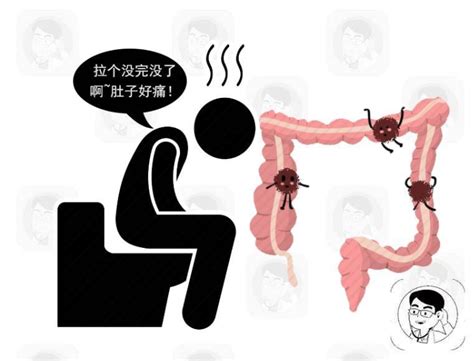 大便湿粘是肠癌？医生提醒：排便时出现4个现象，需尽早就医检查肠癌大便检查肠道症状 健康界