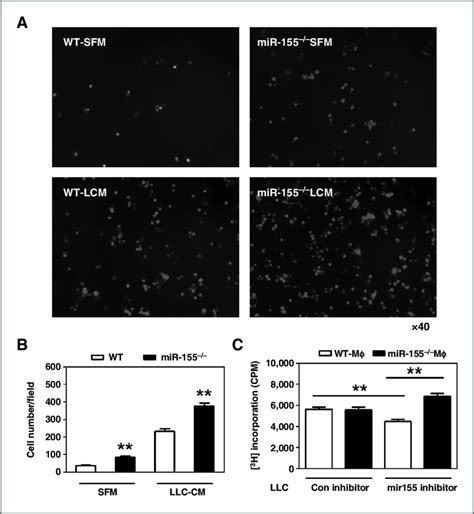 Mir 155 ÀÀ Macrophages Promote Tumor Cell Migration And Proliferation Download Scientific