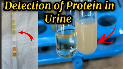 How To Detect Protein In Urine Rowwhole