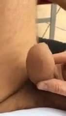 Phimosis Gay Man Porn XHamster