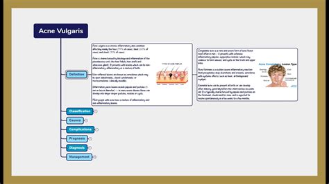 Acne Vulgaris Symptoms Diagnosis Treatment Youtube
