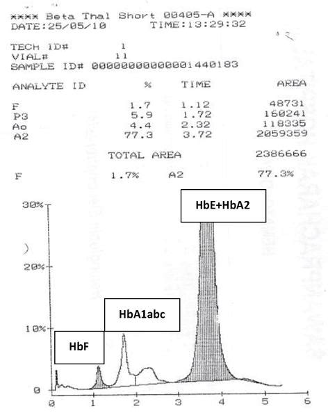 Laboratory Diagnosis Of Thalassemia And Hbe Intechopen