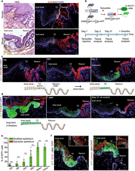 A Population Of Basal Keratin Cells At The Anorectal Junction