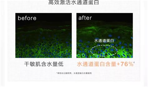 一键重启健康肌，薇诺娜特润霜修护烂脸养“厚”脸皮 知乎