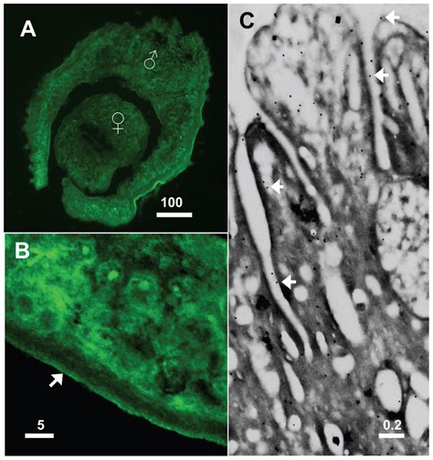 Immunolocalization Of SmAP In Adult Parasites A Cross Section Through