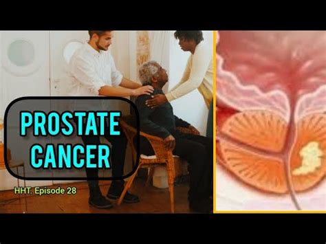 Prostate Cancer Full Video In English Holistichealth Talk